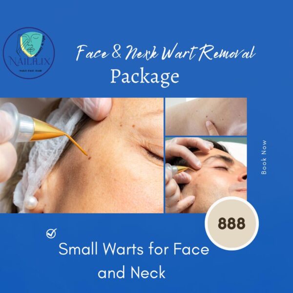 FACE AND NECK WART REMOVAL