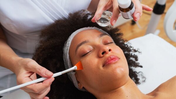 Chemical Peel Facial